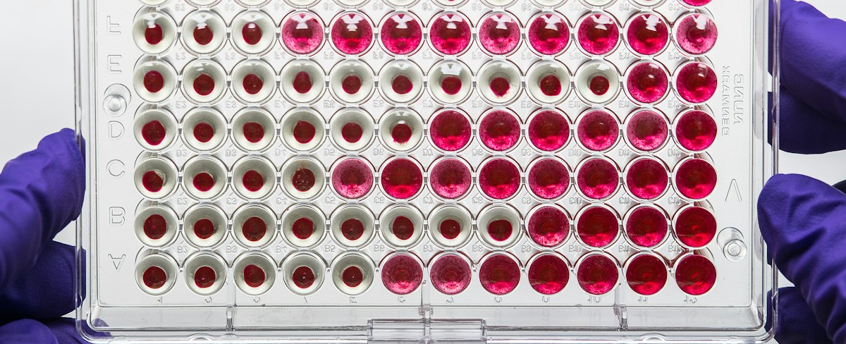 Micro array Data Analysis